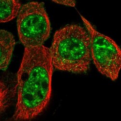Cysteine Rich Tail 1 Antibody, Novus Biologicals 0.1mL; Unlabeled:Antibodies,